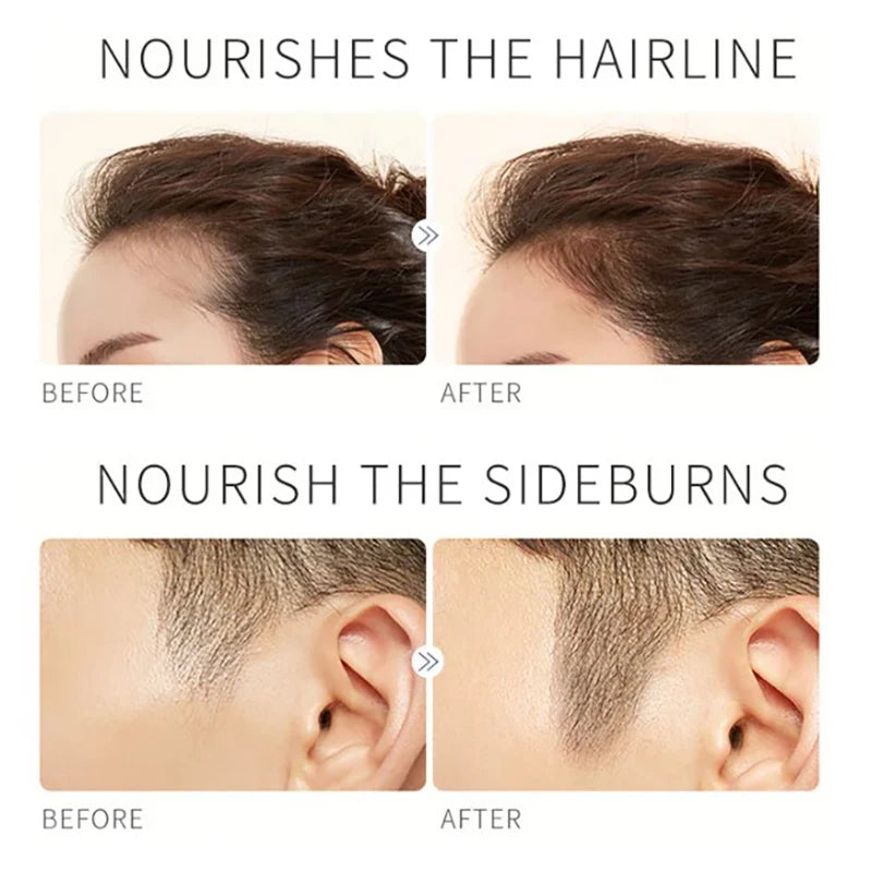 Eyelashes Eyebrow Growth Serum Nourish Liquid Extension Intensive Lengthen Follicles Hairline Lashes Enhancer Thick Growth Serum